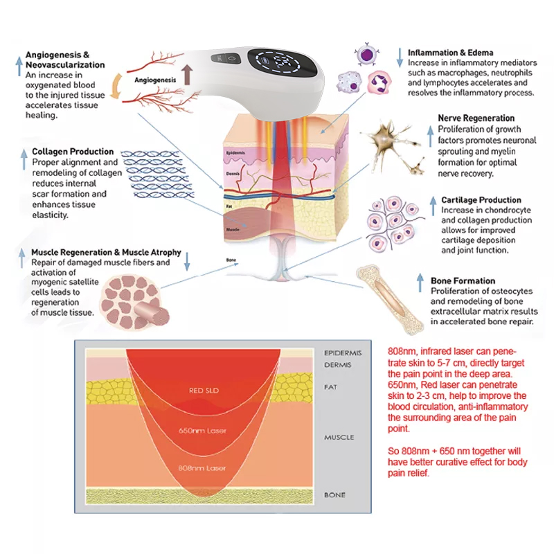 2x808nm Cold Laser Therapy Dev - Pet Supplies Outlet review and price